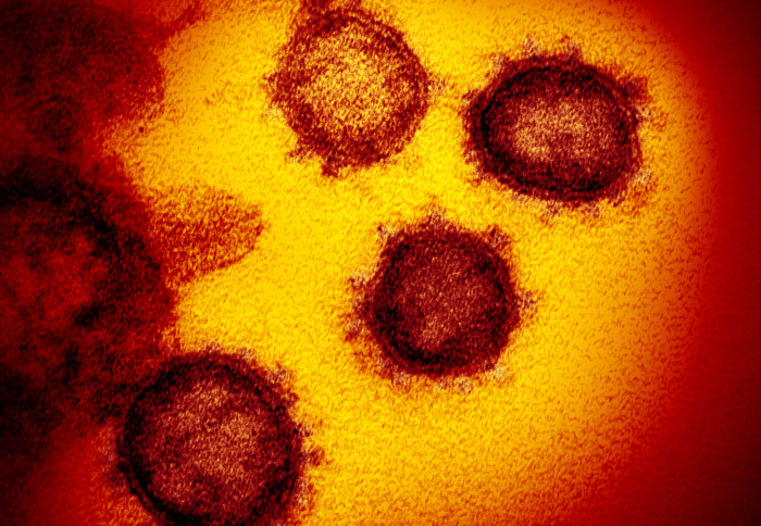 SARS-CoV-2 virus under electron microscope
