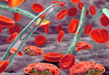 New Link Between Malaria Genetics and Sickle Haemoglobin Identified