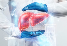 Kisspeptin reduces liver damage in non-alcoholic fatty liver disease in mice
