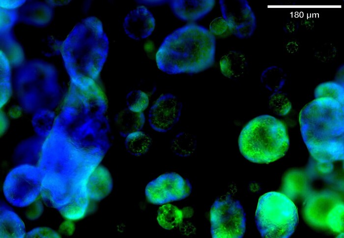 3 dimensional (3D) human colon organoids in which the nuclei and the tight junctions had been labelled (blue and green, respectively)