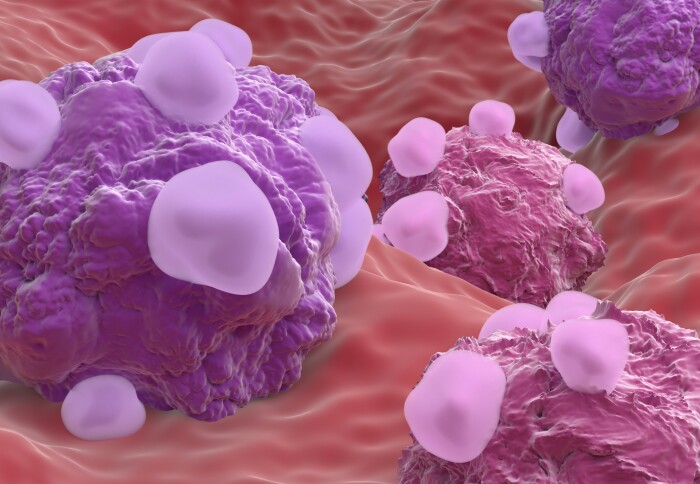 Ovarian cancer cell variations - closeup view 3d illustration