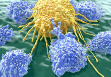 NK:IO raises further investment for cell therapy targeting ovarian cancer