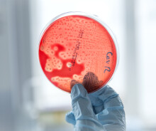 Researcher holds up a petri dish culturing Strep A. bacteria
