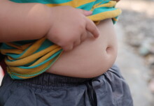 Study reveals alarming mortality risk in children with extreme genetic obesity
