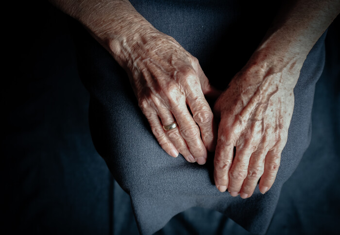 Ageing hands