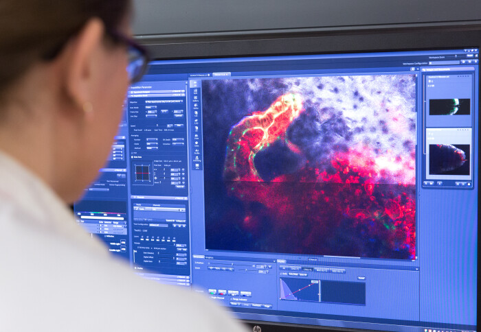 Researcher looking at an image of cells on a computer screen