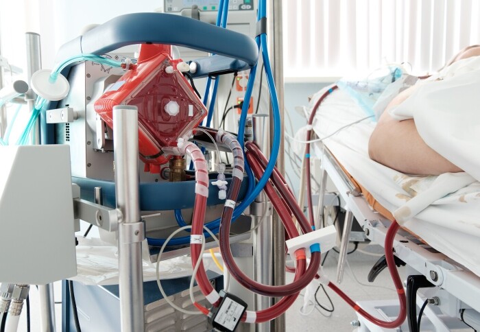 Working ecmo machine in intensive care department