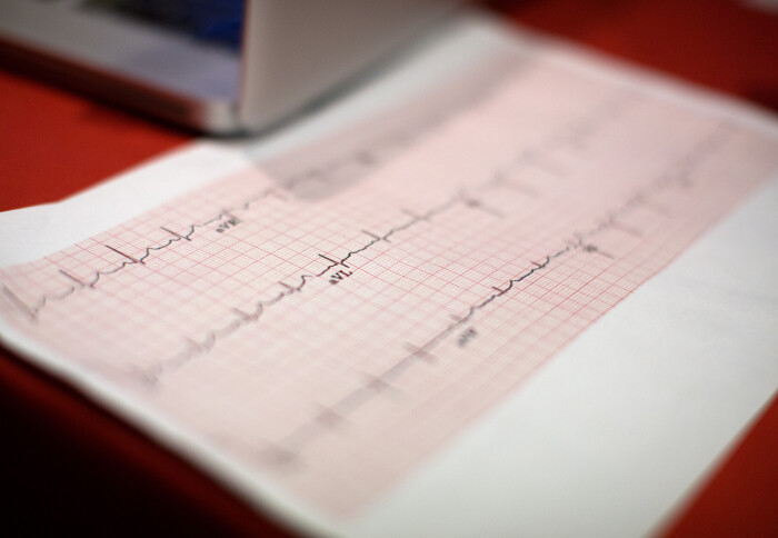 ECG printout