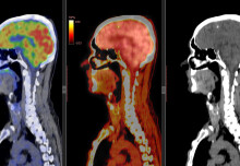 Ministers unveil new scanner to speed up diagnosis and treatment of disease