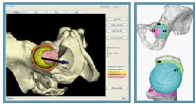 Anatomical registration