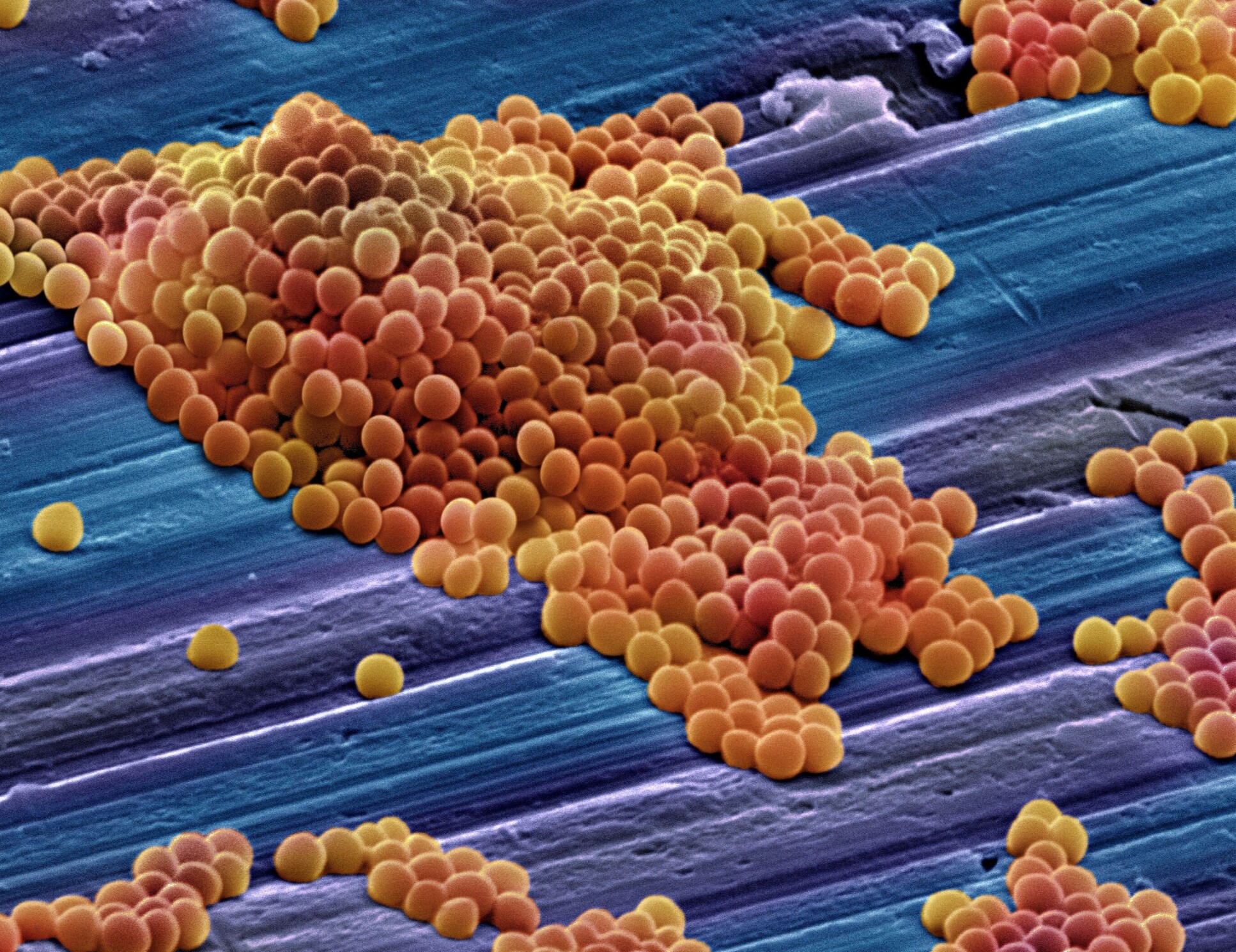 MRSA bacteria