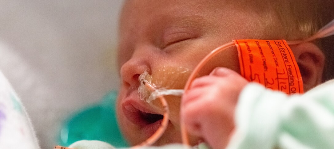 Baby with feeding tube