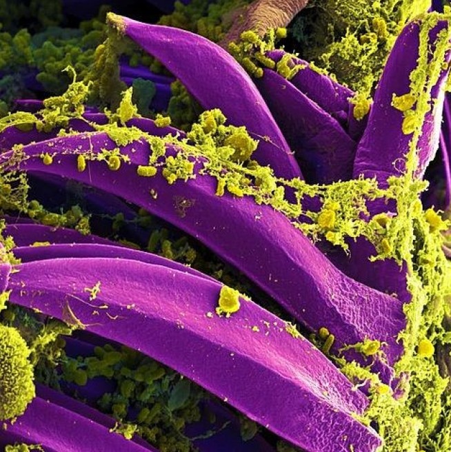 Yersinia pestis Bacteria