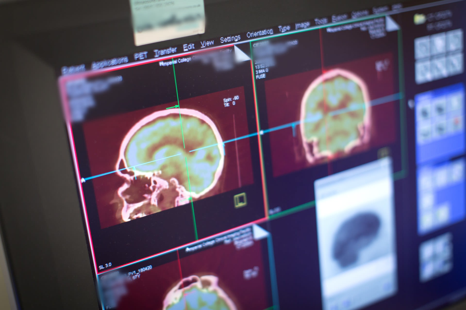 25 years of groundbreaking cancer research