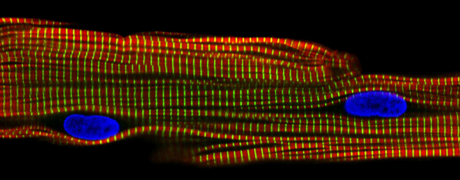 Microscopic image of mitochondria