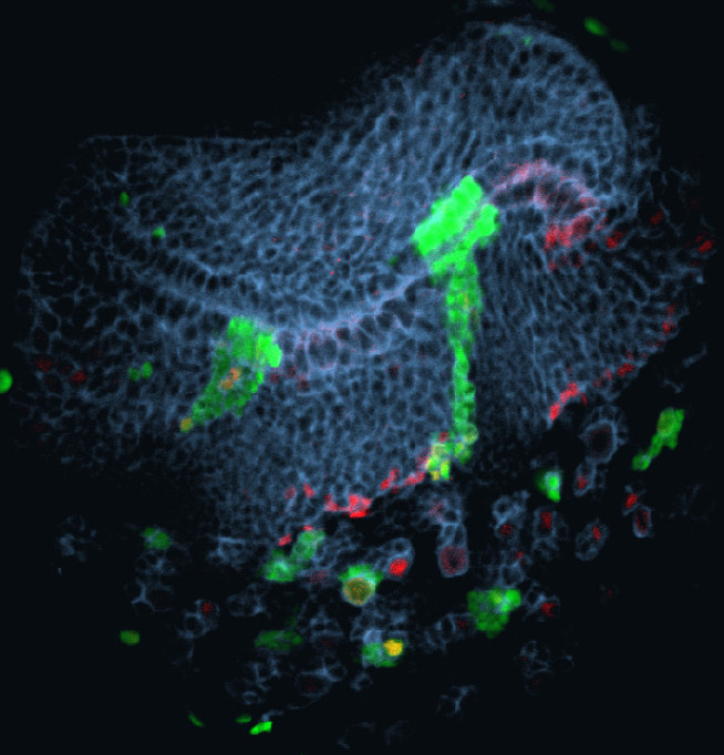 Drosophila larval brain lobe with MARCM clones expressing GFP (green), anti-Dpn (red) and anti-Dlg (blue)