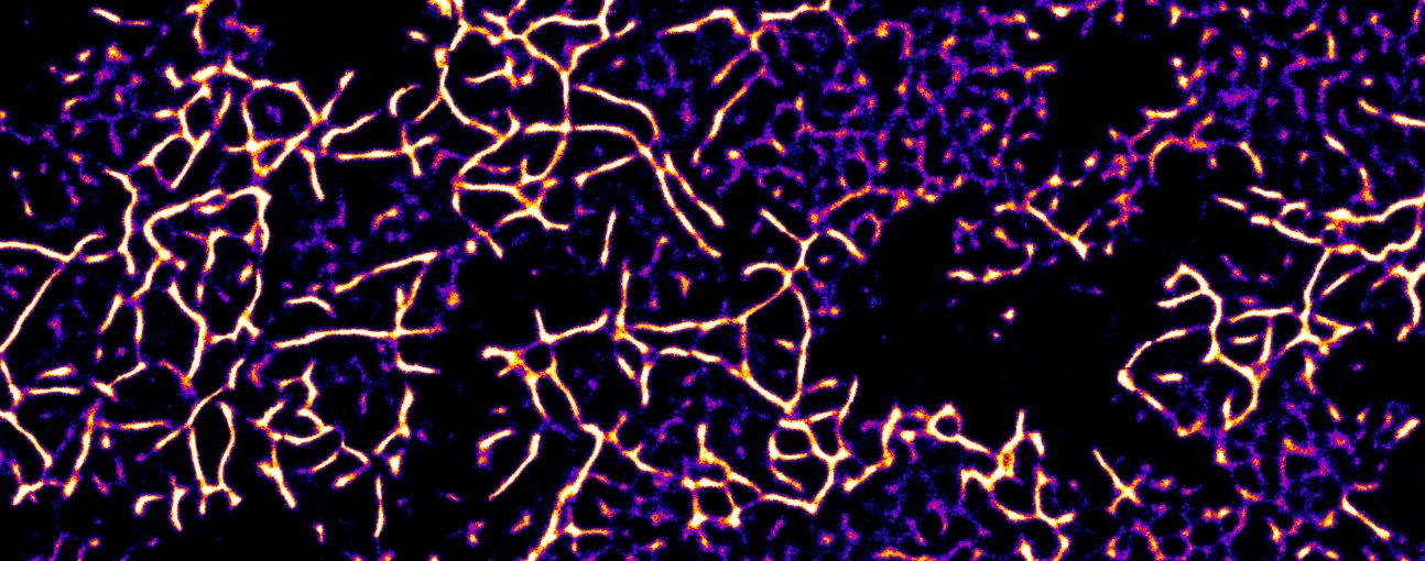 fluorescent image alpha synuclein aggregates