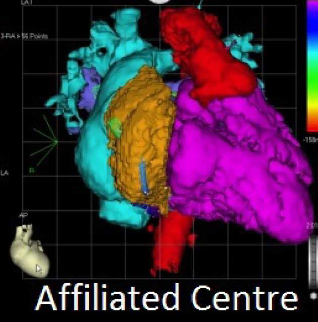 BHF Centre of Research Excellence