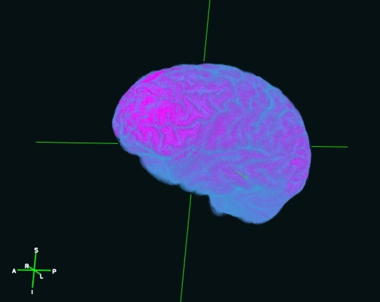 3D reconstruction of the brain of the artist