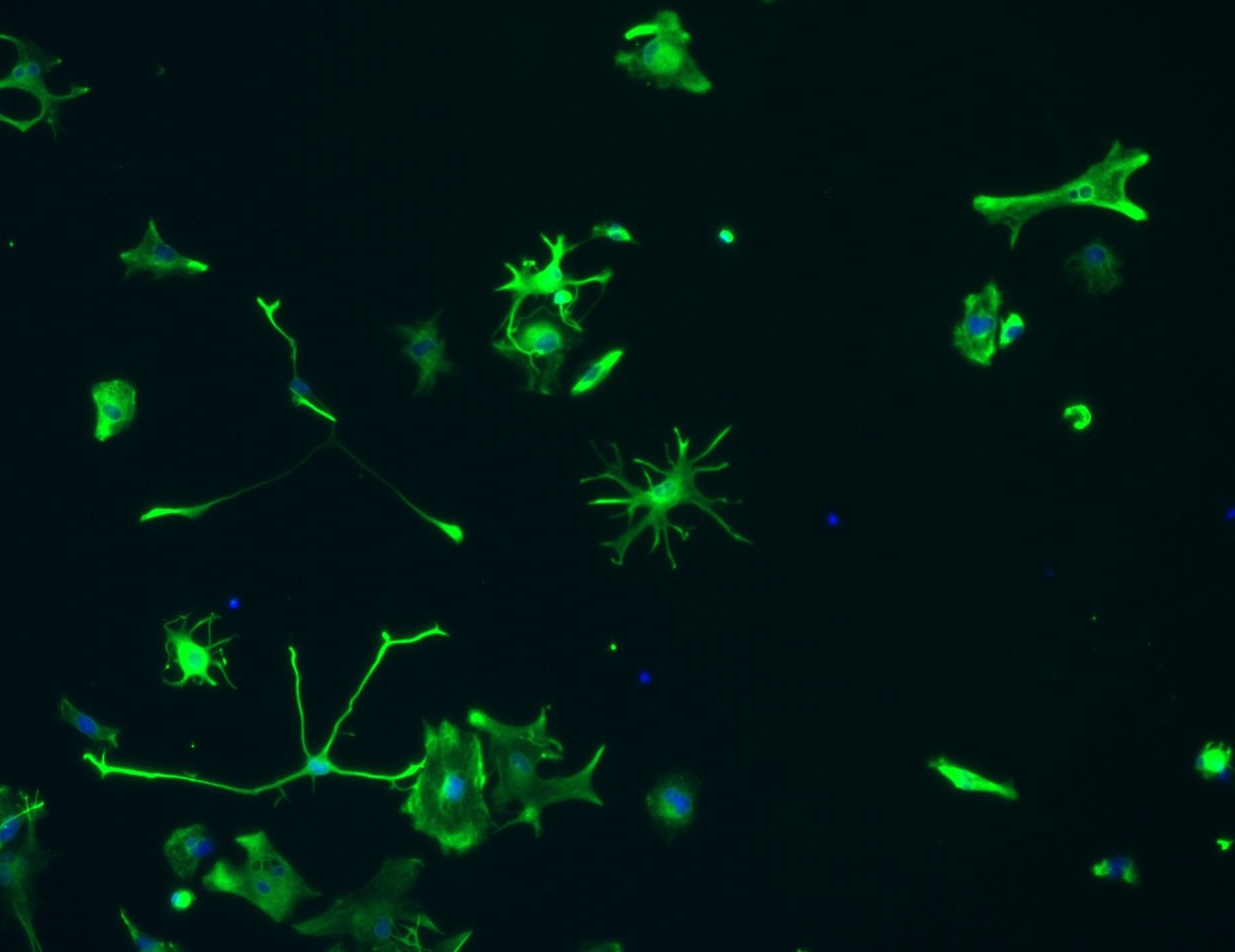fluorescent image of astrocytes