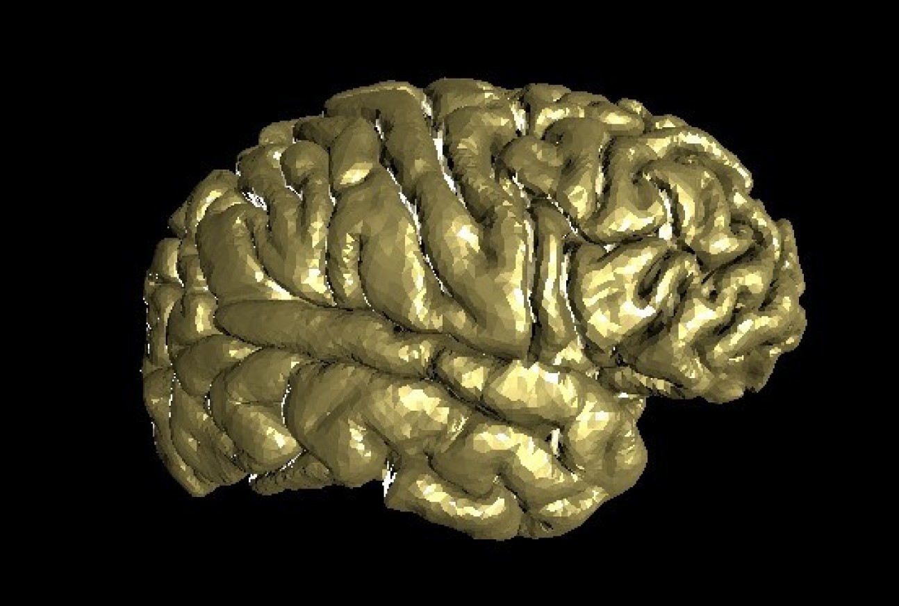3D surface reconstruction of the brain of the artist