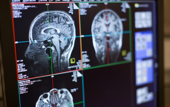 MRI screen output