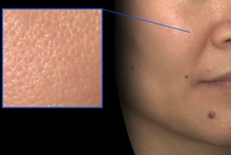 Detailed facial image showing skin texture