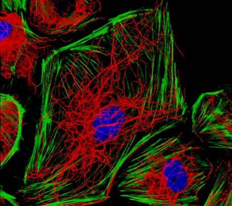 Endothelial cells with actin stress fibres in green and microtubules in red