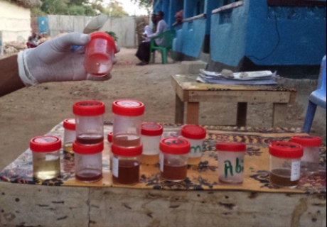 Figure 4. Collecting stool and urine samples from children. These are urine sampled showing obvious blood in the urine, probably resulting from S. haematobium infection