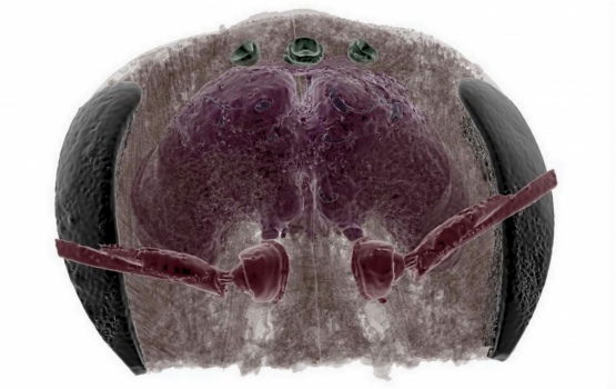 Transparent head case showing the brain