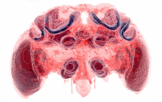 Transparent brain tissue showing brain structures