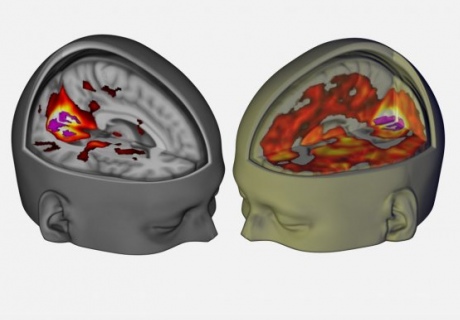 An illustration of brain activity