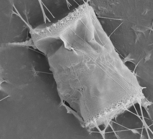 An image of a diatom showing initricate lace-like patterns itched across its shell-like exterior