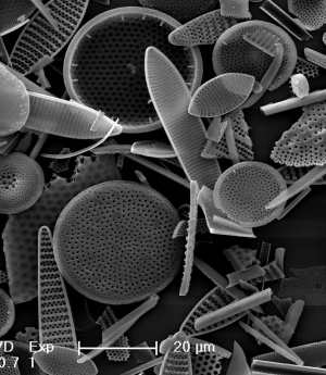 A bloom of diatoms showing distinctive triangle, circle and arrow shapes