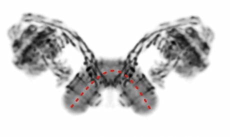 Black and white image of a molecule with spread wings