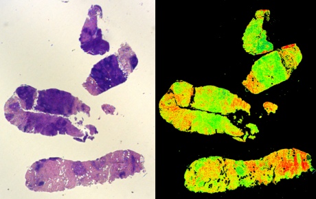 Purple and blue blobs of tissue and same image with defined green and red parts.