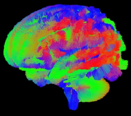 Image analysis enables scientists to see the connections between brain cells in the infant brains