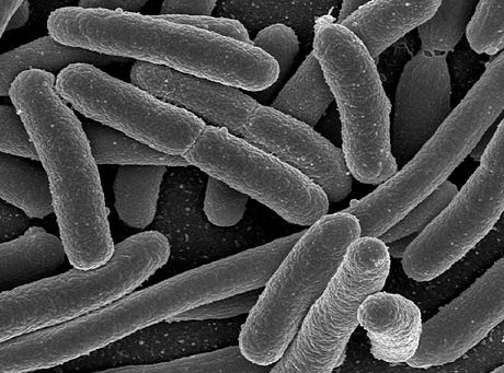 Escherichia coli is just one of the many species of bacteria in the human gut