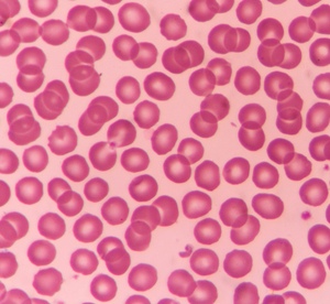 The majority of the body's iron is locked up in haemoglobin – the protein complex in red blood cells (pictured)