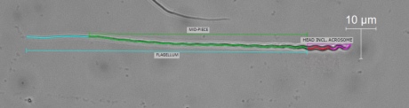 Long sperm under a microscope