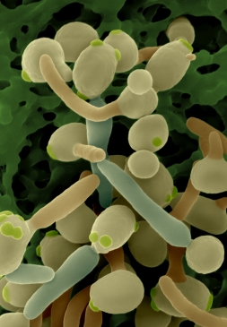 Microscope view of candida albicans cells at different stage. Kindly provided by Dennis Kunkel, Inc.