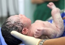 Caesarean babies are more likely to become overweight as adults