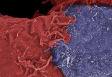 Natural Killer cell findings should help fight against diseases like leukaemia