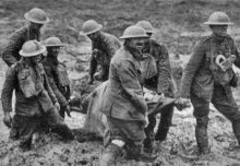 WW1 surgeons could do little for amputees' pain