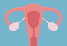 &apos;Simple rules' calculate ovarian cancer risk 