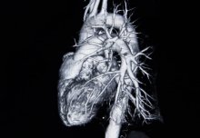 Immune system linked to lower heart attack risk, study suggests