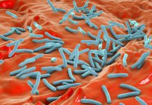 New insight into the progression of tuberculosis infection
