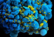 Three ways Imperial scientists are leading the fight against HIV/AIDS