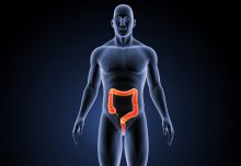 Bowel scope cuts cancer risk for at least 17 years