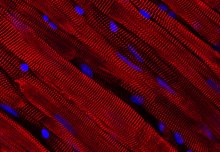 Ultra-thin tissue samples could help researchers to treat heart disease